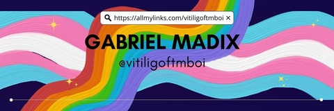 Header of vitiligoftmboi